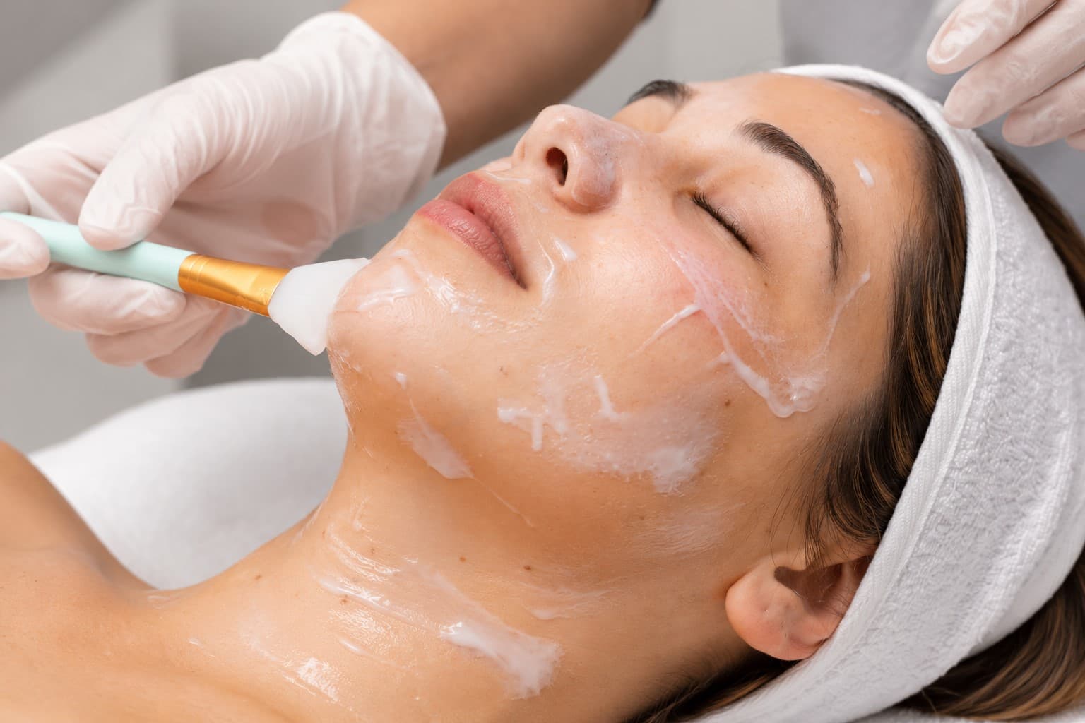 Peeling cosmiátrico
